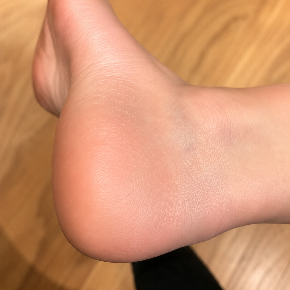 After