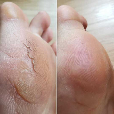 Lunari Pieds de Soie™